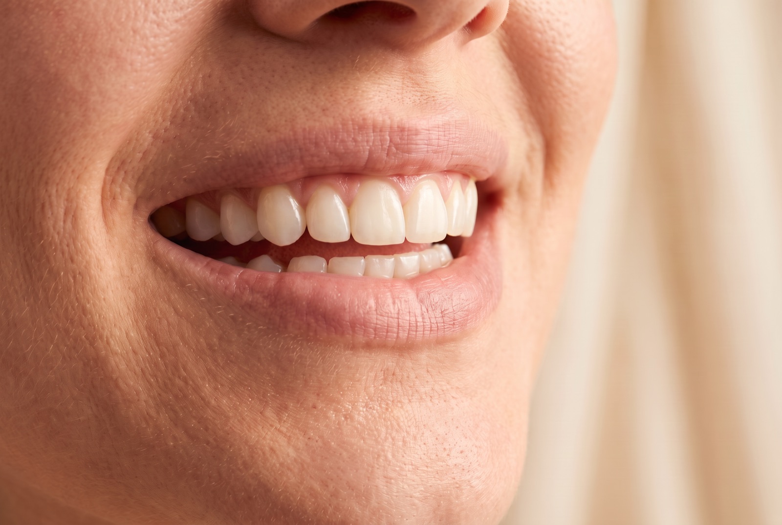 La misma sonrisa con dientes más claros después del blanqueamiento